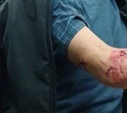 حمله پلنگ به یک دامدار در ارتفاعات اطاقور لنگرود ؛